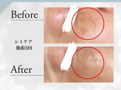 ブレリアントサロン 池袋店(brillant salon)の写真