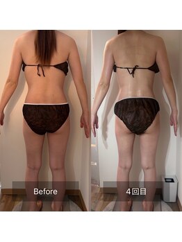 フィエルテ 甲斐敷島(FIERTE)/お客様beforeafter