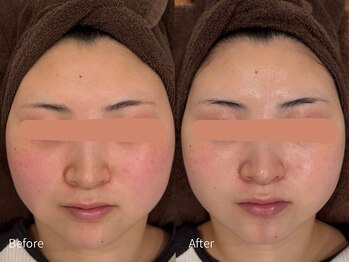 アウラ 小杉店(AULA)/ララピール☆