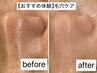 【おすすめ体験】毛穴レス!フェイシャル 25分 ¥2500