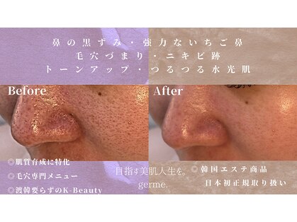 ジェルム(germe.)の写真
