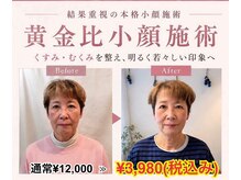 小顔美肌ファクトリー 金沢院