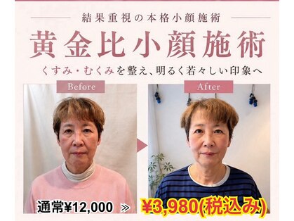小顔美肌ファクトリー 金沢院の写真
