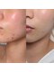 ルーンフェイシャルサロン 吉祥寺(Lune facial salon)の写真/【導入希少】美容大国韓国TOPエステ"トロイアルケ"で1人1人の肌&悩みに合わせた完全オーダーメイド肌管理を