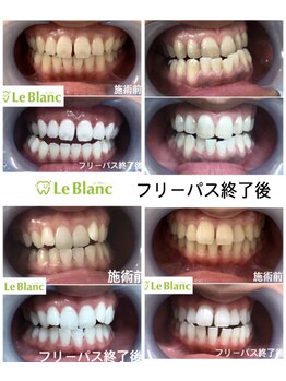 ルブラン 奈良店(Le Blanc)/本来のお色取り戻しましょう