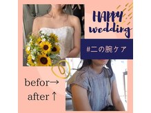 サロン ド ヴィーナス 行田店/二の腕ケア