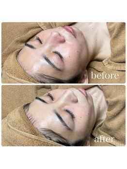 ラクシー 船橋(luxssy)/ララピール