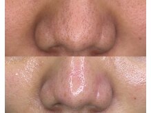 ル シーニュ/カスタムフェイシャル