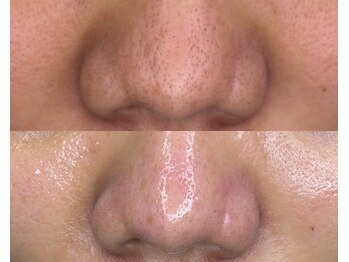 ル シーニュ/カスタムフェイシャル