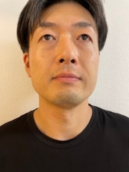 モコ(moco)/脱毛前のお写真です★