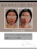 《小顔人気No1》～ヘッドスパ×小顔頭蓋骨調整～　45分｜大人の本気ケア