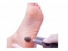 リゼラアンドコー 宇都宮店/かかと角質ケア/足裏角質除去！