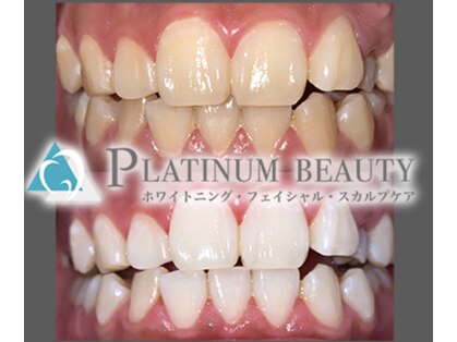 プラチナム ビューティー 川崎店(PLATINUM Beauty)の写真