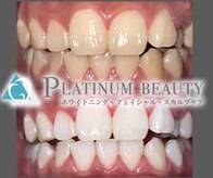 プラチナム ビューティー 川崎店(PLATINUM Beauty)