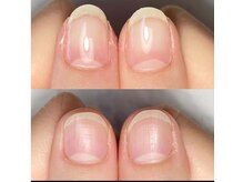 エルアンド(elle＆)/爪のピンク大きく成長