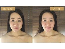 グレースフィオーレ 南越谷店(gracefiore)/南越谷の小顔矯正でトーンアップ