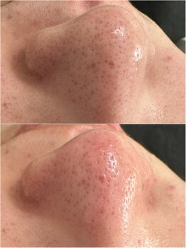 マヴィ くずは店(MavY.)/つまり汚れもすっきり