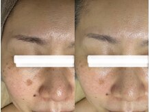 マスカレード 品川(Masquerade)/