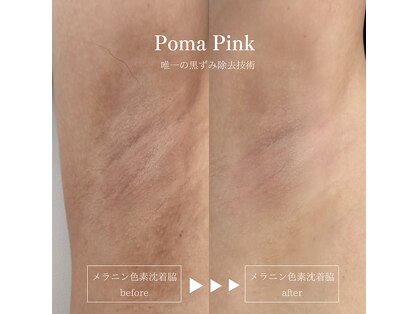 ラ クレール ビューティーサロン(LA CLAIR)の写真