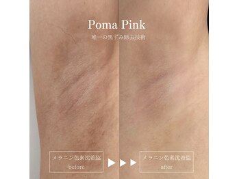 ラ クレール ビューティーサロン(LA CLAIR)