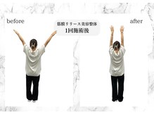 美容整体で驚きの変化《小顔/美姿勢/むくみ解消/可動域UPに◎》