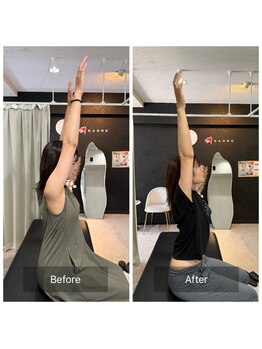 ナオル整体 広島福山院(NAORU整体)/1→2回目変化万歳→Before/After