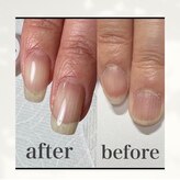 クリムネイル(Culim Nail)