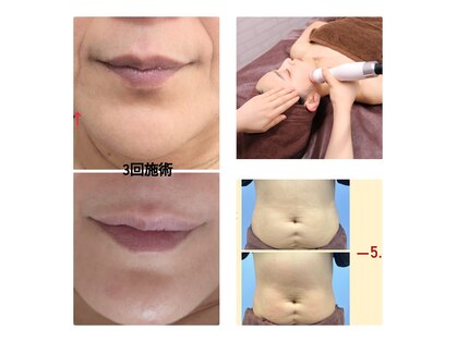 フェリーチェ ビューティー(Felice Beauty)の写真