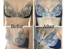 ブレスト 新宿本店(Breast)/《6回目》40代（バストアップ)