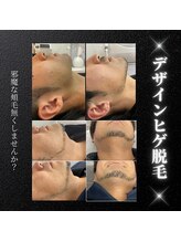 リノミラ(LINOMIRA)/デザイン脱毛