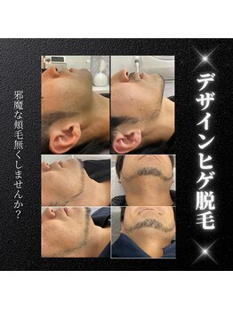 リノミラ(LINOMIRA)/デザイン脱毛