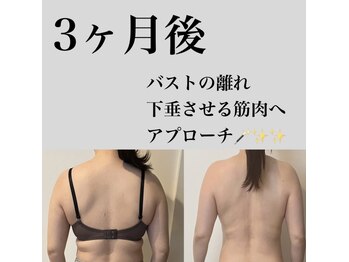 サロンツキ(salon tuki)/【バストケア】症例