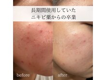 アディクトビューティーの雰囲気（ニキビ、毛穴トラブル、シミケア。根本から整えます。）