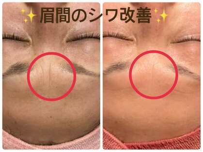 トルル(Tlulu)の写真