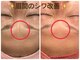 トルル(Tlulu)の写真