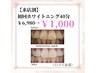 【3日までの来店割】初回ホワイトニング40分 ¥6980→¥1000(口コミ必須)