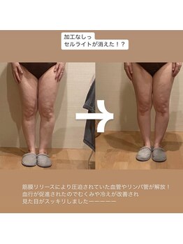 トトノエル(TOTONOEL)/下半身筋膜リリース