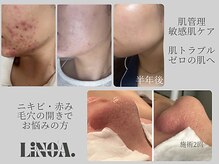 リノアドット(LiNOA.)