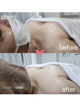 beauty　salon　Cherii【4/1 NEW OPEN（予定）】/バストケア　施術１回目