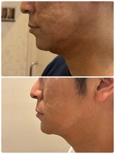 きれいめのタケル/一番人気！レモンボトル