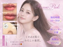 みや美の雰囲気（特許成分セラムで痛みも無く1回の施術でピンク色が2～3年持続！）