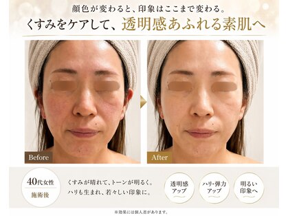 ロイヤル(ROYAL)の写真