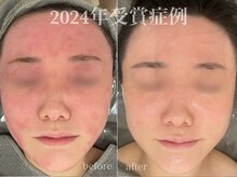 リスト(Rist TOTAL BEAUTY)