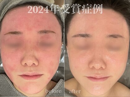リスト(Rist TOTAL BEAUTY)の写真