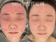 リスト(Rist TOTAL BEAUTY)の写真