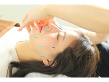 しのとう鍼灸整体院