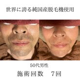 カイ メンズ脱毛アンドネイル(KAI)