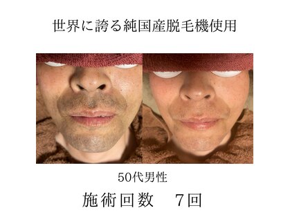 カイ メンズ脱毛アンドネイル(KAI)の写真