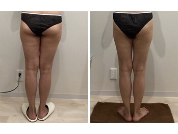 ラナビューティリゾート(Lana Beauty resort)/エステ担当★50代・5きろ減