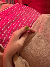 アルバ暁子鍼灸治療院(alba暁子鍼灸治療院)/目の違和感にお灸